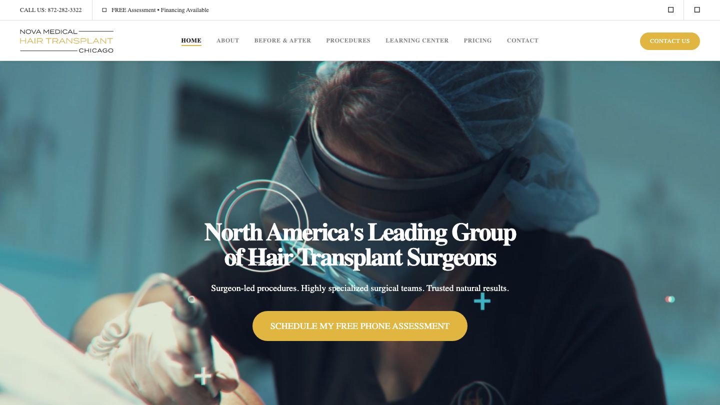 Chicago Hair Transplant | Nova Medical