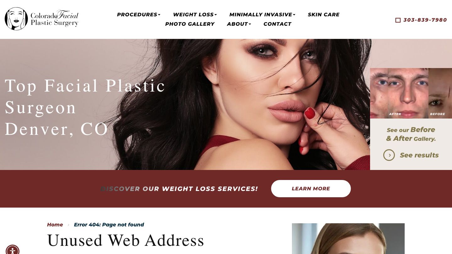 Colorado Facial Plastic Surgery