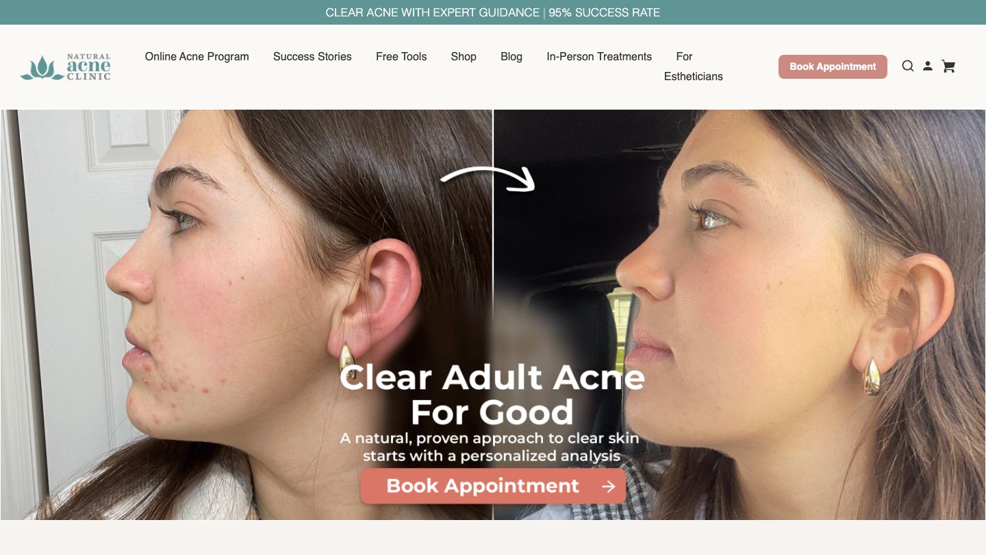 Natural Acne Clinic