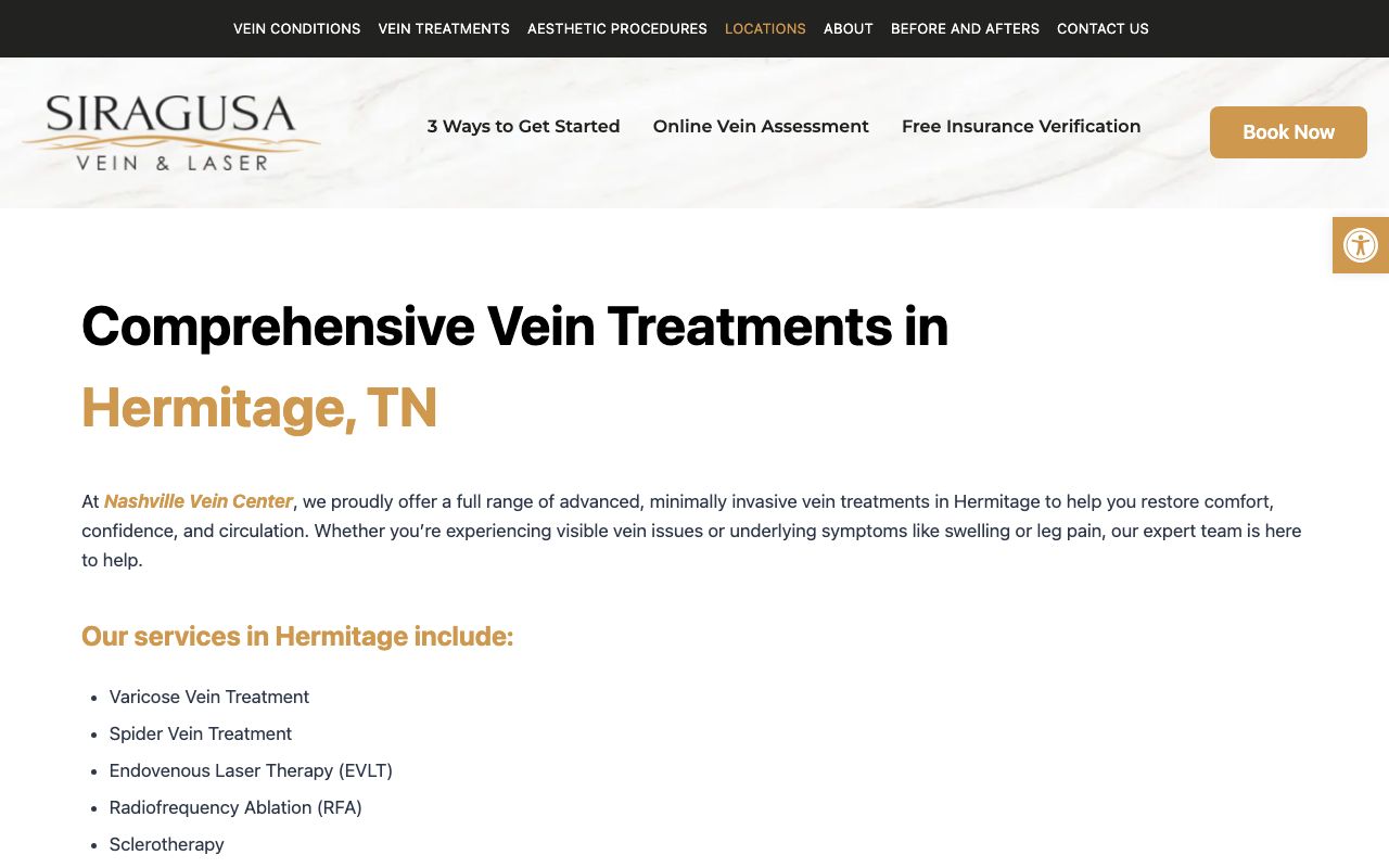 Siragusa Vein and Laser