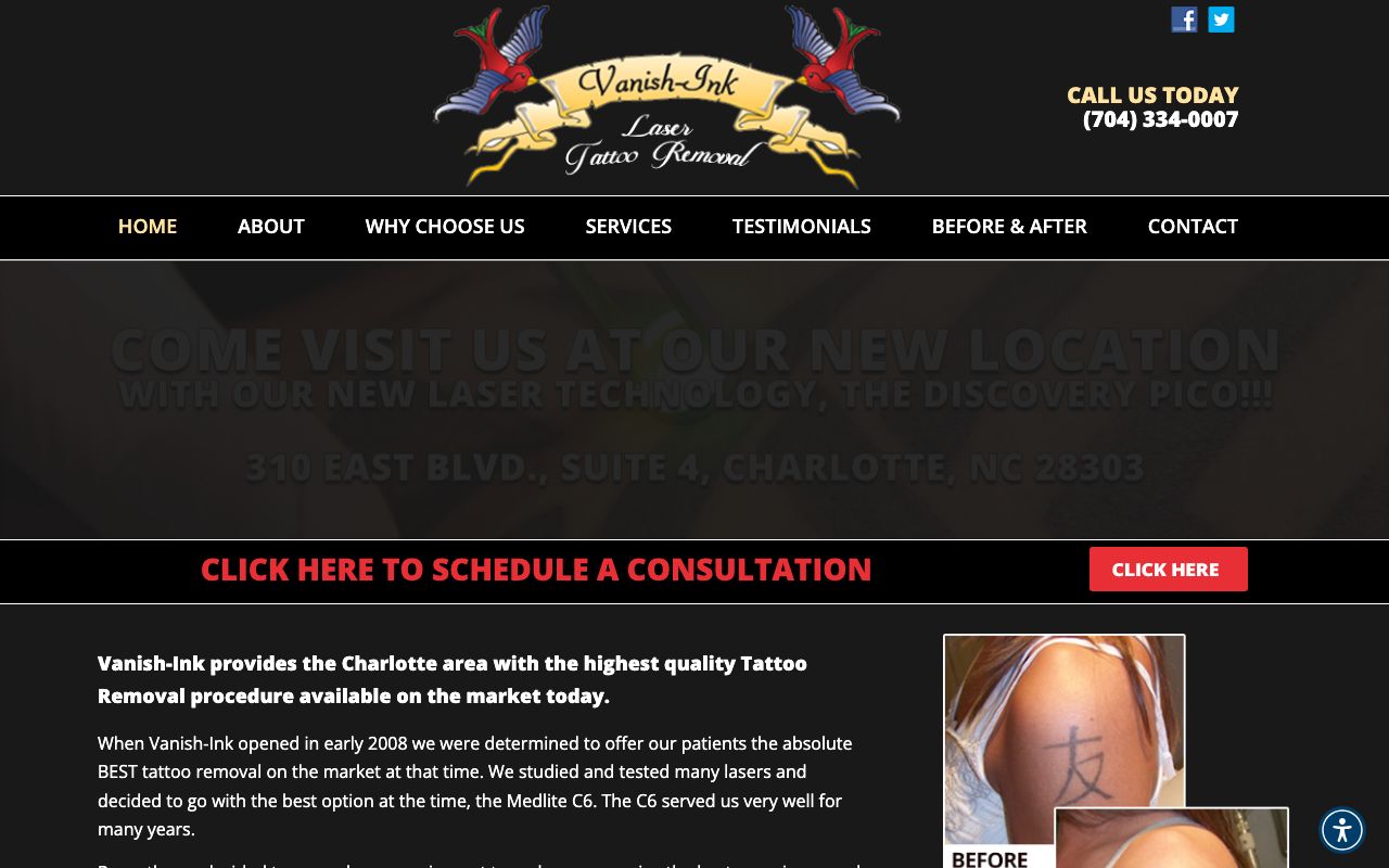 Vanish-Ink Laser Tattoo Removal